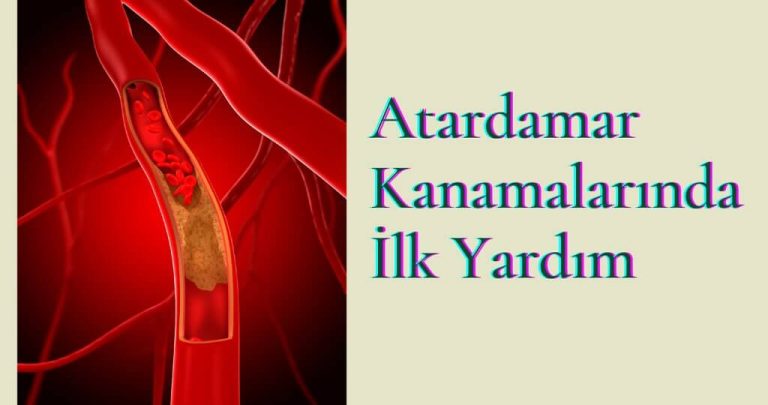 Atardamar Kanamalarında İlk Yardım
