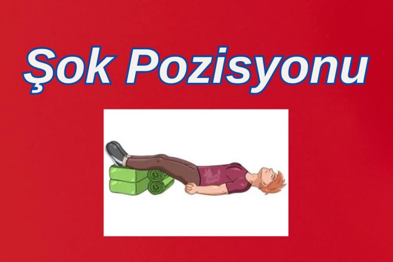 Şok pozisyonu verme