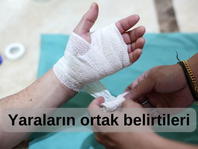 Yaraların Ortak Belirtileri