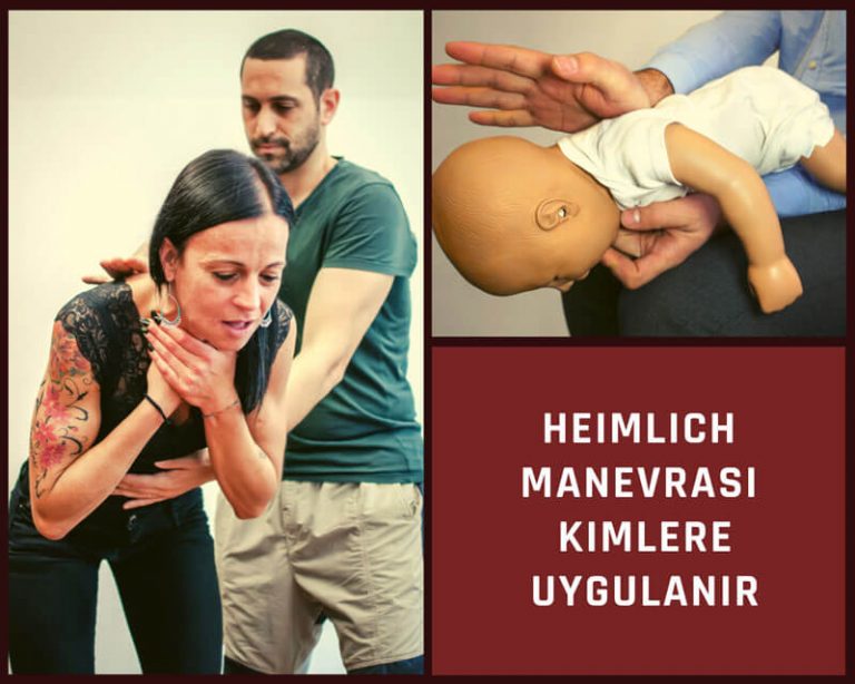 Heimlich Manevrası Kimlere Uygulanır?